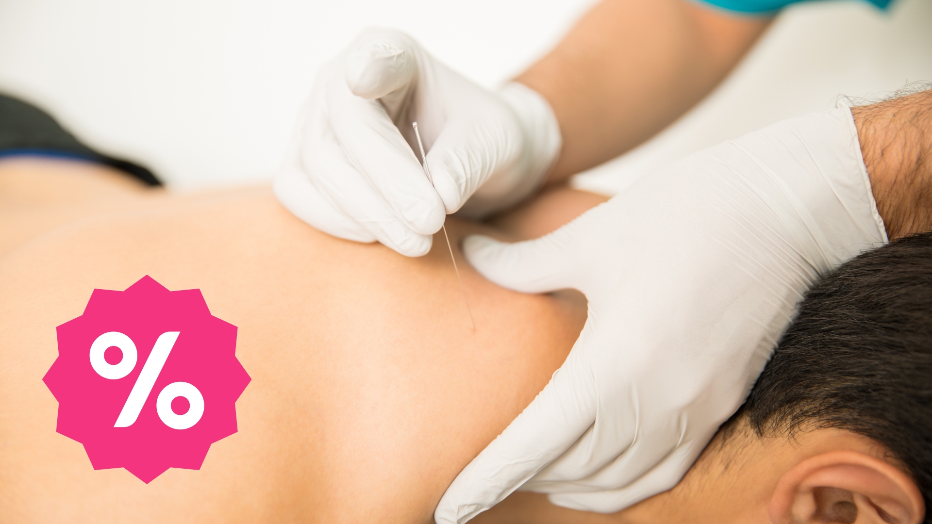 Harga Promo Dry Needling untuk Redakan Nyeri dan Ketegangan Otot