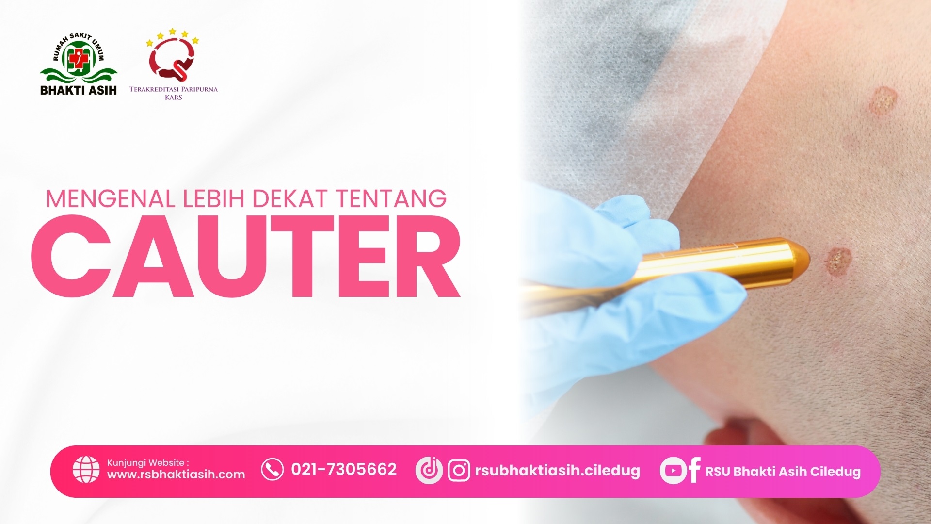 Mengenal Cauter: Prosedur Medis untuk Mengatasi Jaringan Abnormal